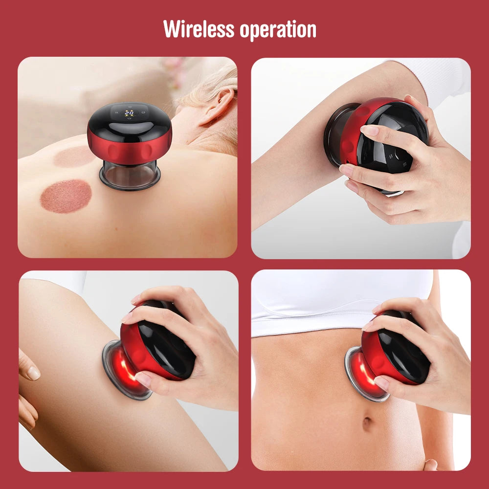 Electric Vacuum Cupping Therapy Suction Cups - Zenvoy