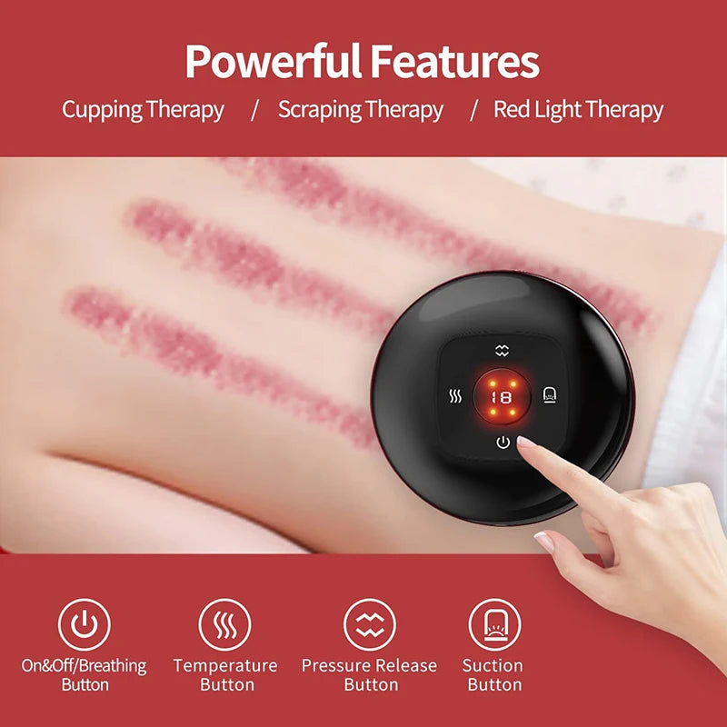 Electric Vacuum Cupping Therapy Suction Cups - Zenvoy